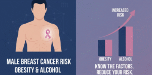 Male Breast Cancer Risk from Obesity and Alcohol
