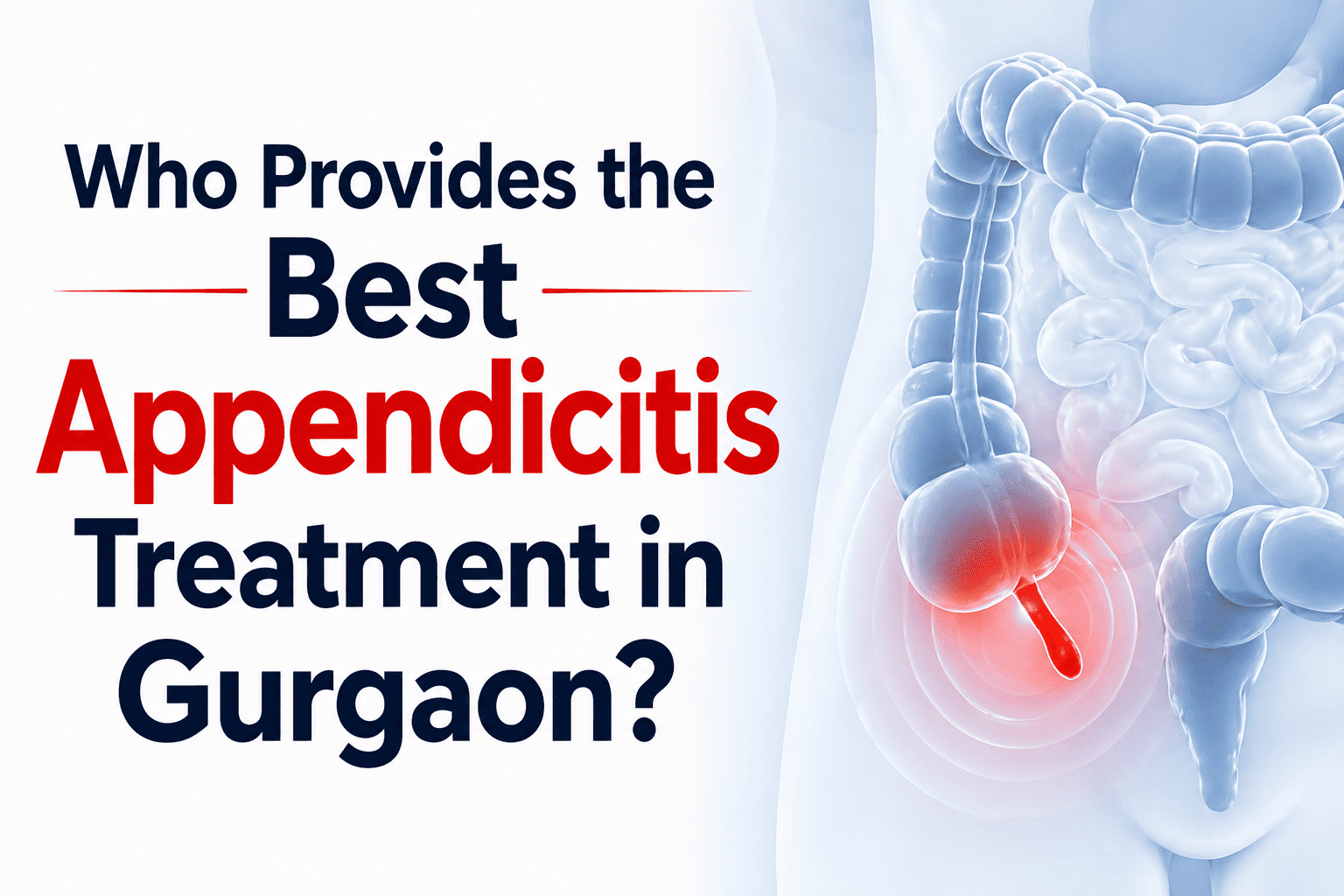 Who Provides the Best Appendicitis Treatment in Gurgaon?