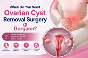 When Do You Need Ovarian Cyst Removal Surgery in Gurgaon?