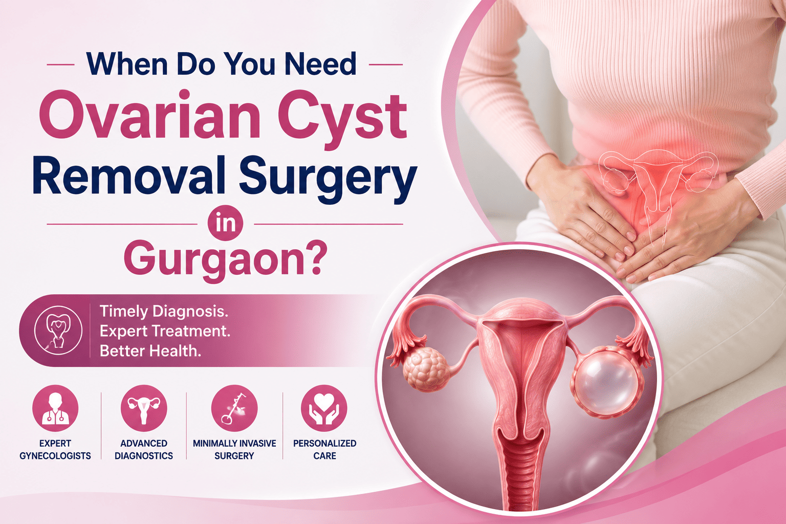 When Do You Need Ovarian Cyst Removal Surgery in Gurgaon?